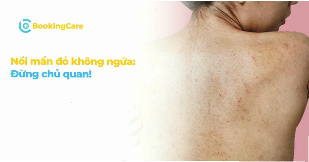 Nổi mẩn đỏ không ngứa: Đừng chủ quan!