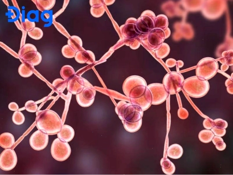 Nổi mẩn ngứa khắp người do nhiễm trùng nấm trên da