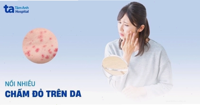 Nổi mụn đỏ trên da là dấu hiệu của nhiều bệnh lý khác nhau