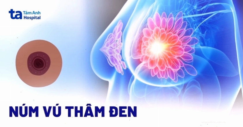 Núm vú bị thâm