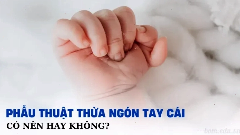 Phẫu thuật tay 6 ngón có thay đổi vận mệnh không?