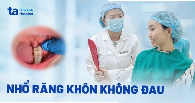 Quy trình nhổ răng khôn không đau tại nha khoa