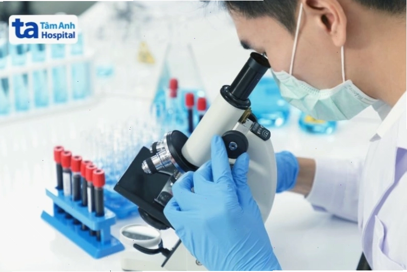 Quy trình thực hiện xét nghiệm suy giảm miễn dịch