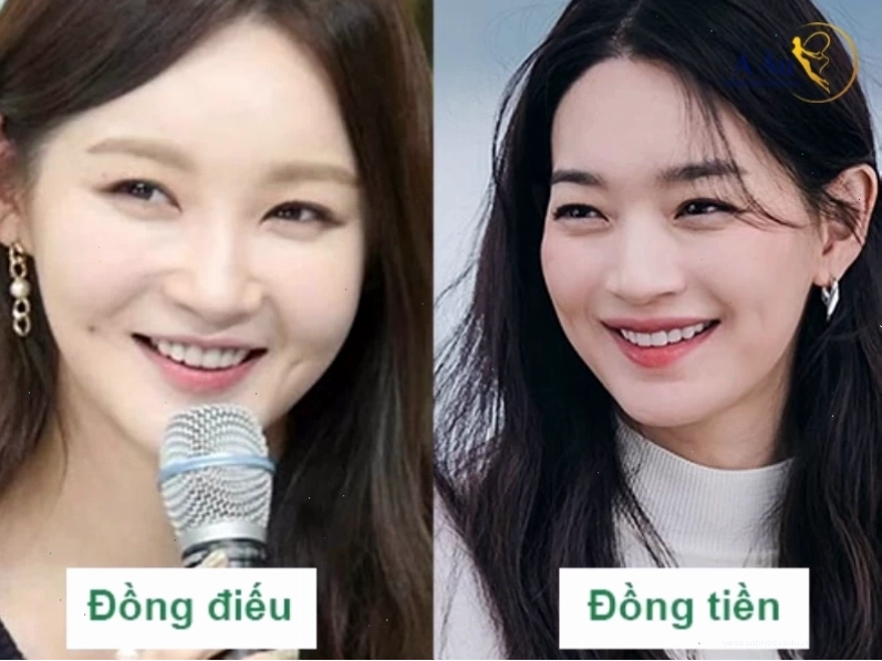 So sánh má lúm đồng điếu và má lúm đồng tiền