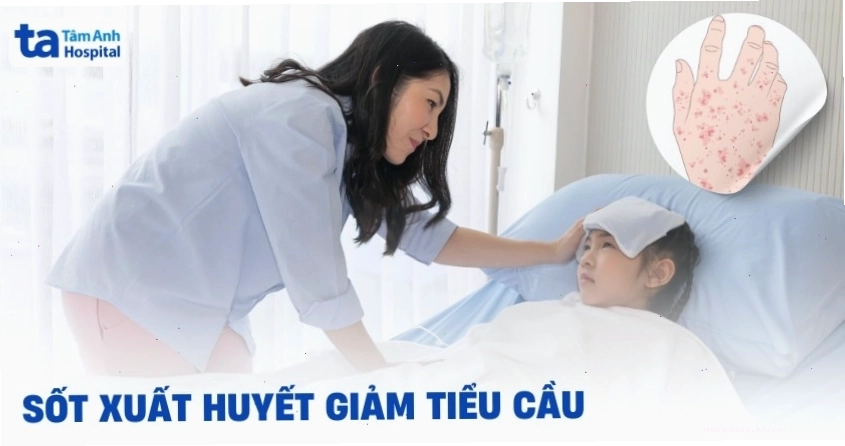 Sốt xuất huyết giảm tiểu cầu là một tình trạng y tế khẩn cấp