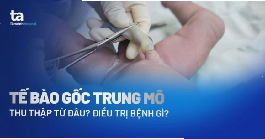 Tế bào gốc trung mô