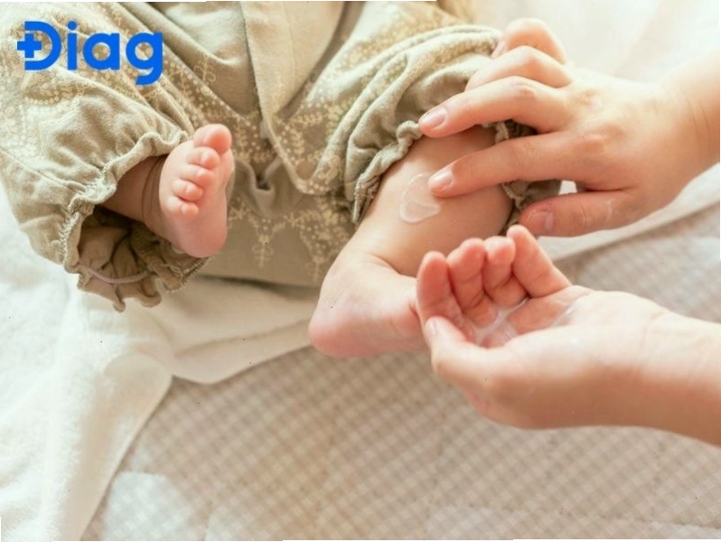 Thoa kem dưỡng ẩm giúp làm dịu da cho trẻ bị nổi mề đay