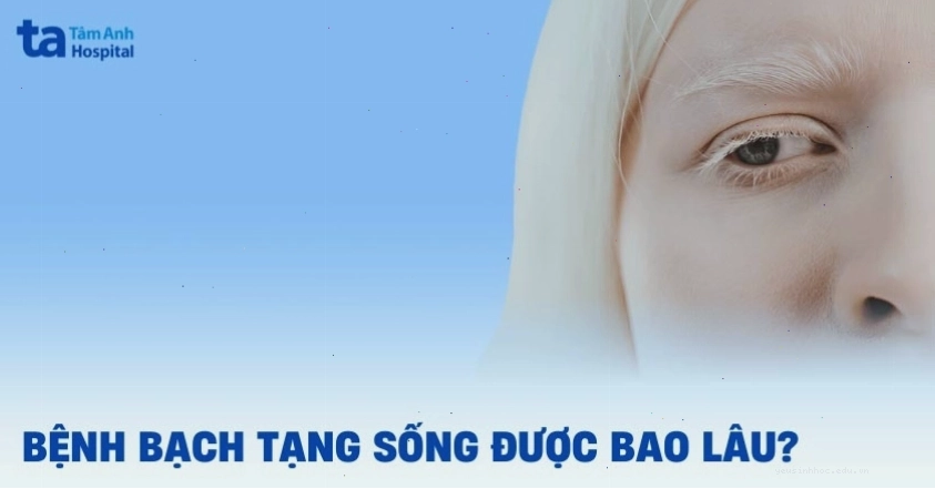 Thời gian sống của người bị bệnh bạch tạng