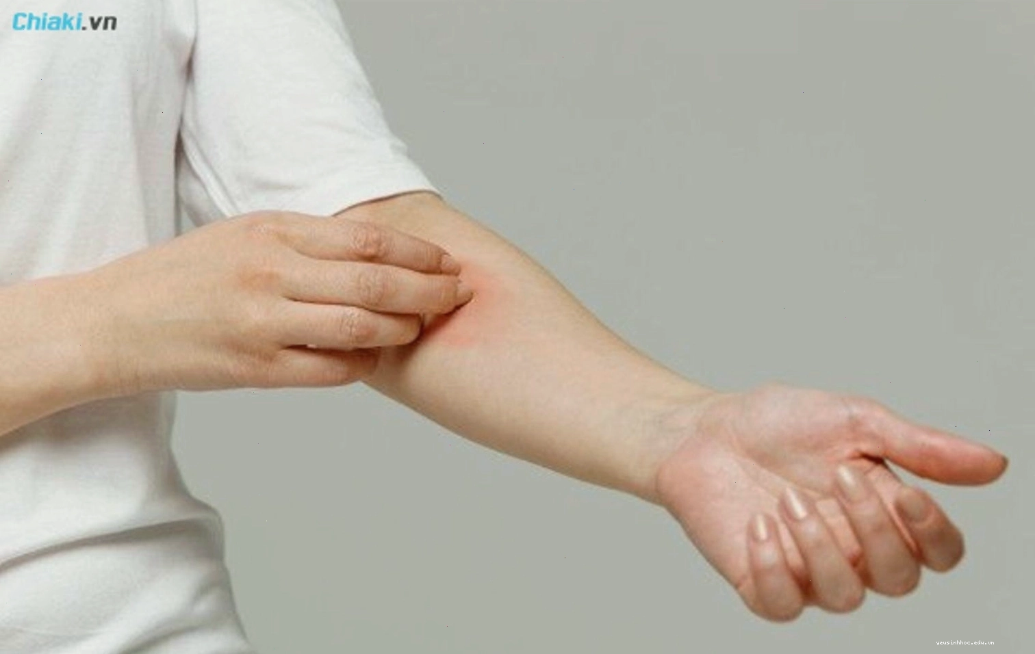 Tiêu chí chọn kem trị hăm da người lớn
