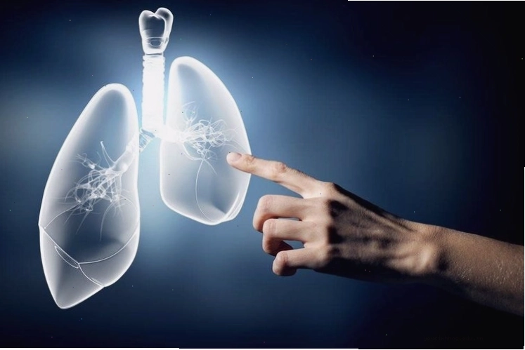 Trẻ em bị viêm phổi là một trong những dấu hiệu suy giảm miễn dịch