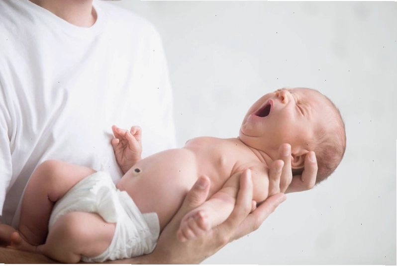 Trẻ mắc hội chứng Edward thường có tiên lượng xấu