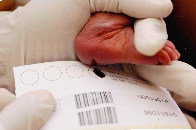 Trẻ sơ sinh được sàng lọc Galactosemia bằng xét nghiệm máu gót chân