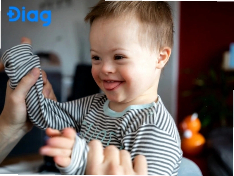 Trisomy 21 là dạng hội chứng Down phổ biến nhất, trong đó có ba bản sao nhiễm sắc thể số 21.