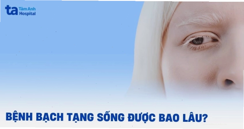 Tuổi thọ người bạch tạng tùy thuộc vào dạng bệnh và biến chứng đi kèm.