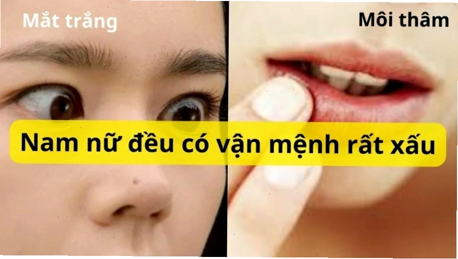 Tướng mạo người môi thâm theo quan niệm dân gian