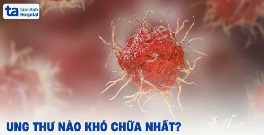 Ung thư nào khó chữa nhất