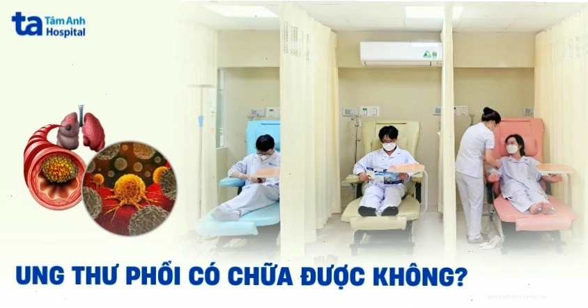 Ung thư phổi có chữa được không
