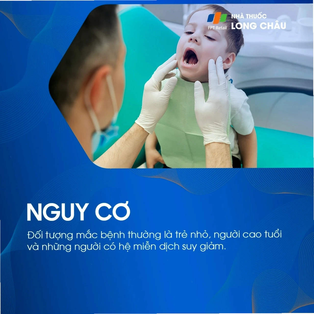 Vệ sinh răng miệng đúng cách là quan trọng