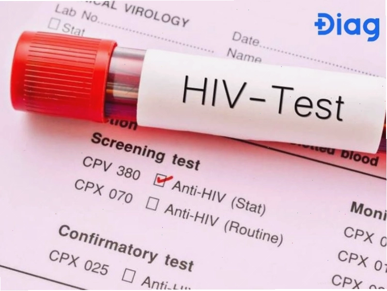 Xét nghiệm HIV giai đoạn 2 cho kết quả chính xác