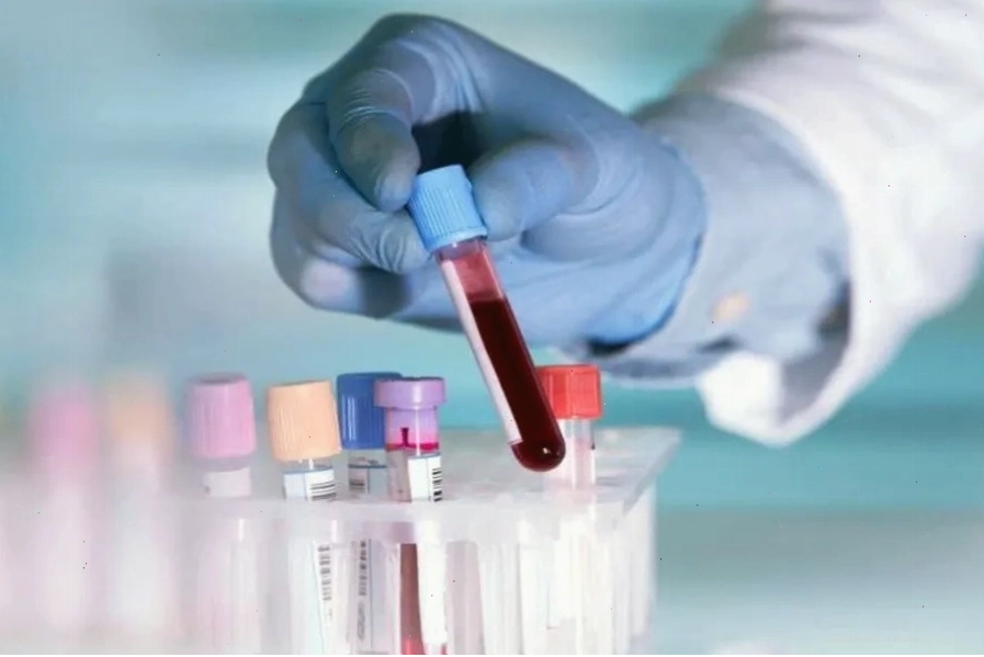 Xét nghiệm máu tiền hôn nhân giúp giảm nguy cơ sinh con mắc Thalassemia