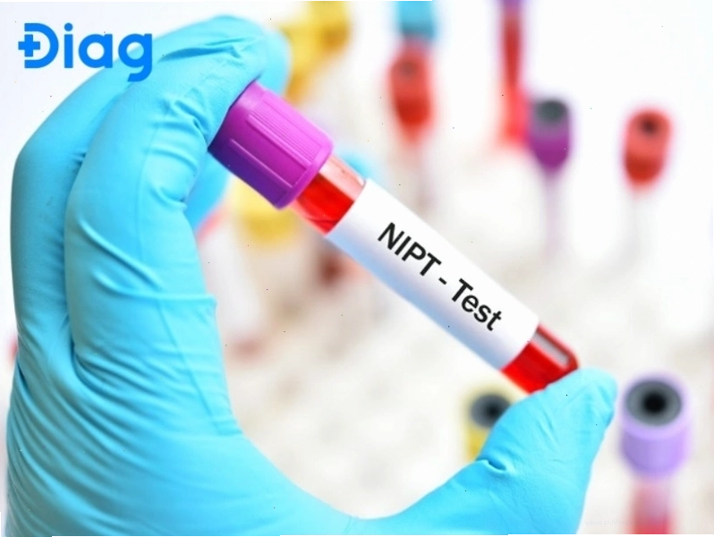 Xét nghiệm NIPT giúp phát hiện sớm bất thường bẩm sinh từ tuần thứ 10 của thai kỳ.
