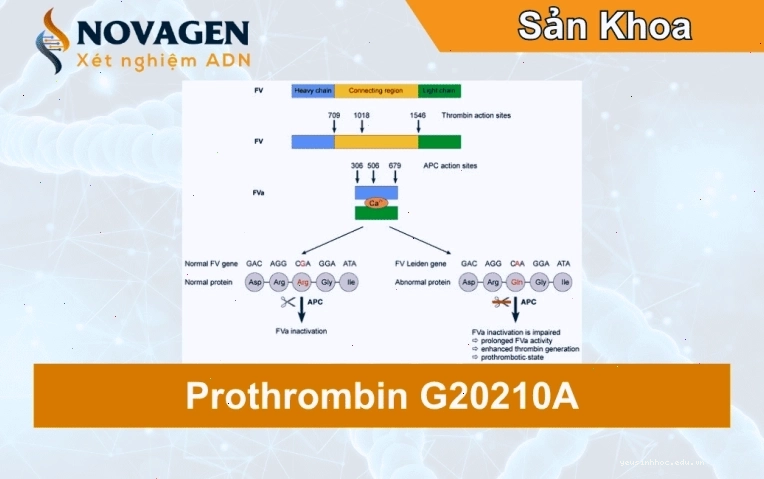 Xét nghiệm Prothrombin G20210A liên quan đến rối loạn đông máu
