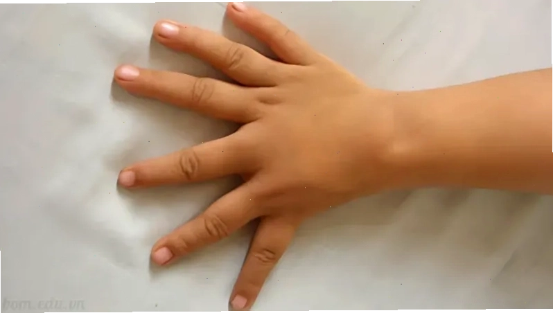 Ý nghĩa tướng số của người có 6 ngón tay