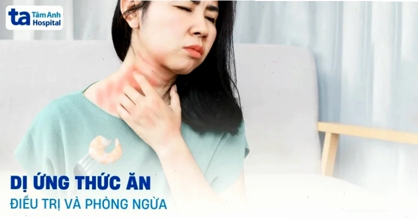 Minh họa cơ chế dị ứng thức ăn