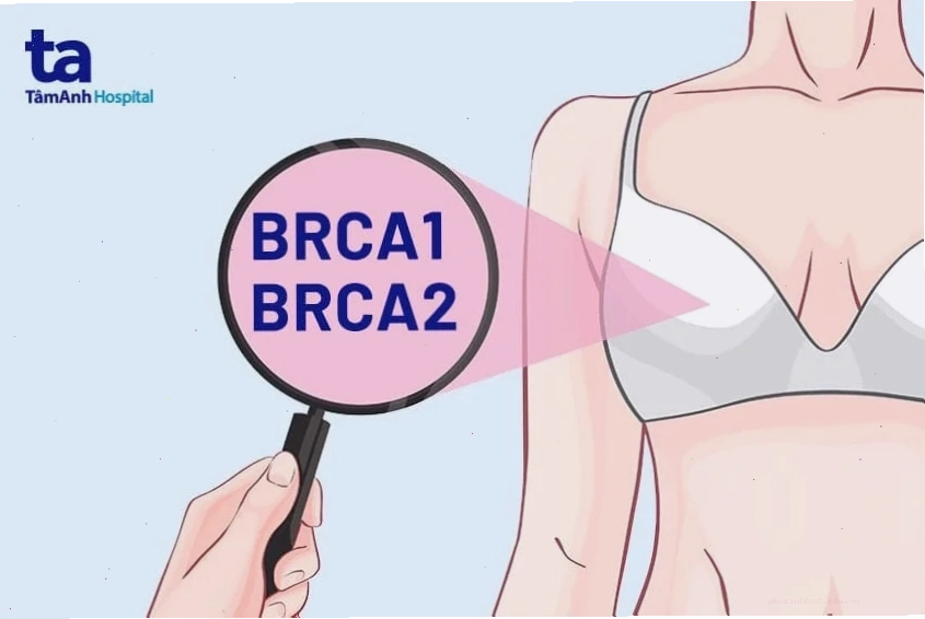 Những lưu ý khi xét nghiệm BRCA