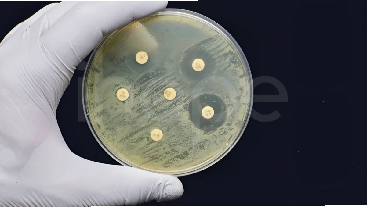 Vi khuẩn E.coli mang gen kháng kháng sinh