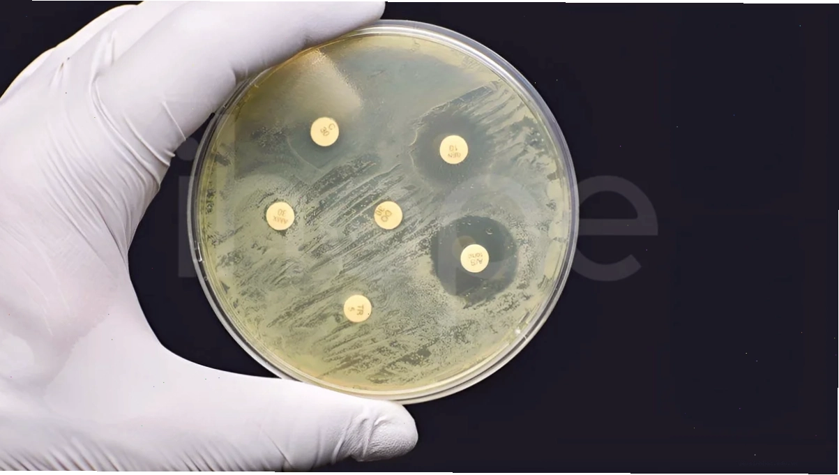 Vi khuẩn E.coli mang gen kháng kháng sinh