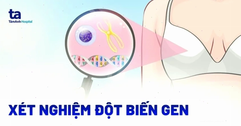 xét nghiệm đột biến gen BRCA