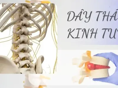 Dây thần kinh tủy - Vị trí, cấu tạo và chức năng trong cơ thể