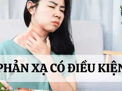 Phản xạ có điều kiện ở cơ thể người