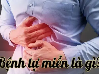 Giải mã bí ẩn về bệnh tự miễn - Nỗi ám ảnh của hệ miễn dịch