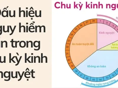 Top dấu hiệu nguy hiểm ẩn trong chu kỳ kinh nguyệt cần biết