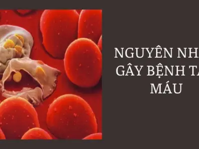 Bệnh tan máu bẩm sinh và những kiến thức quan trọng cần biết