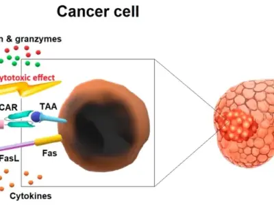 Tế bào CAR-T - Cận cảnh "vũ khí" tiêu diệt ung thư