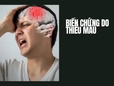 Trải nghiệm của tôi về bệnh hồng cầu liềm và những cơn đau
