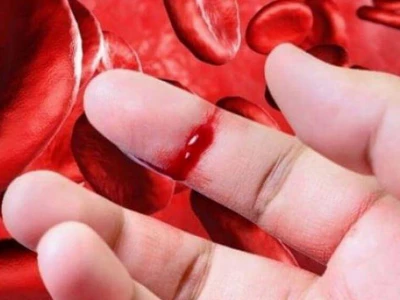 Bệnh Mù Màu và Máu Khó Đông: Hiểu Rõ Cơ Chế Di Truyền