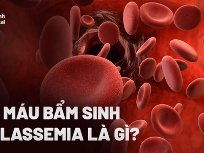 Bệnh Thalassemia ở người lớn: Dấu hiệu nhận biết và cách quản lý hiệu quả