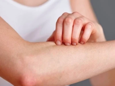 Bị ngứa khắp người không rõ nguyên nhân: Nguyên nhân và cách xử lý