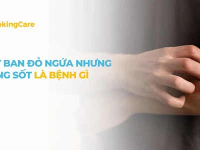 Bị Nổi Ban Đỏ Khắp Người: Nguyên Nhân, Dấu Hiệu và Cách Xử Lý