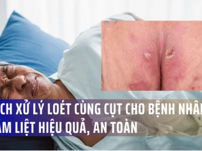 Các loại thuốc trị lở loét cho người già hiệu quả và cách sử dụng