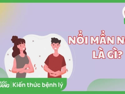 Dị ứng nổi mẩn khắp người: Nguyên nhân, dấu hiệu và cách xử lý hiệu quả