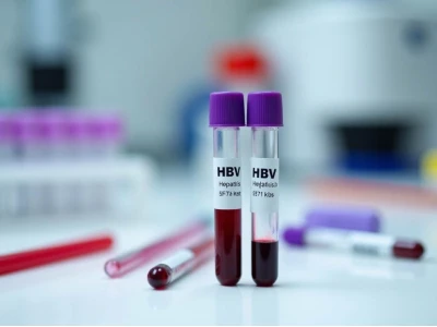 HBsAg Miễn dịch Tự động: Xét nghiệm Quan trọng Chẩn đoán Viêm gan B