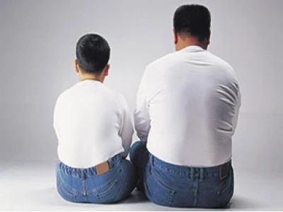 Hình ảnh người béo phì: Cái nhìn đa chiều về sức khỏe và xã hội