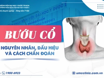 Hình ảnh người bị bướu cổ: Nhận biết sớm qua những dấu hiệu đặc trưng