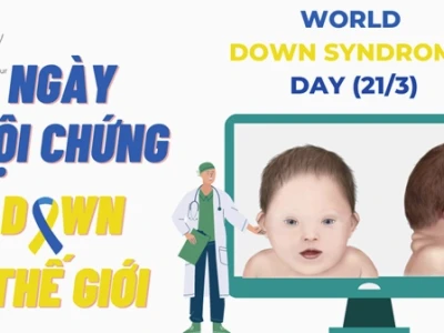 Hội chứng Down (Đao) là gì? Nguyên nhân, dấu hiệu và cách chăm sóc