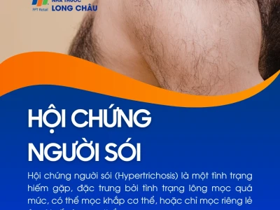 Hội chứng người sói: Nguyên nhân, triệu chứng và cách đối phó